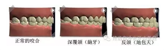 口腔檢查都有哪些流程？