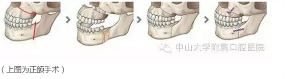 402.png 402.png