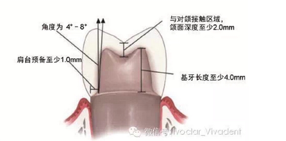 時(shí)常搞不清楚怎么備牙嗎？義獲嘉教您如何完美備牙