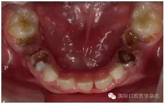 640.webp.jpg