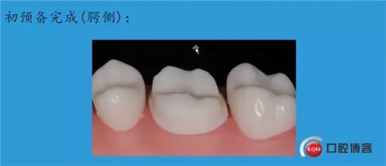 12.webp.jpg 12.webp.jpg