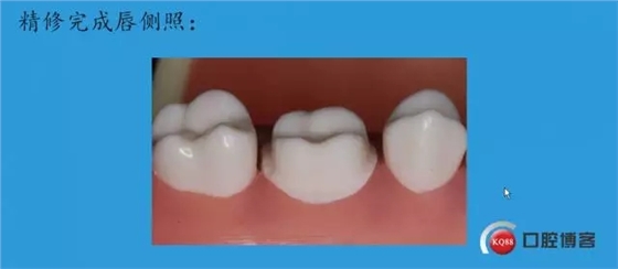 15.webp.jpg 15.webp.jpg