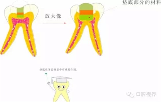 【愛牙科普知識(shí)300問】 “什么是活髓切斷術(shù)？”