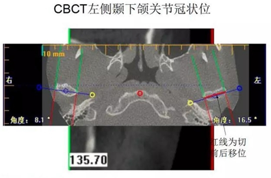 	口腔修復治療中，常見臨床接診流程
