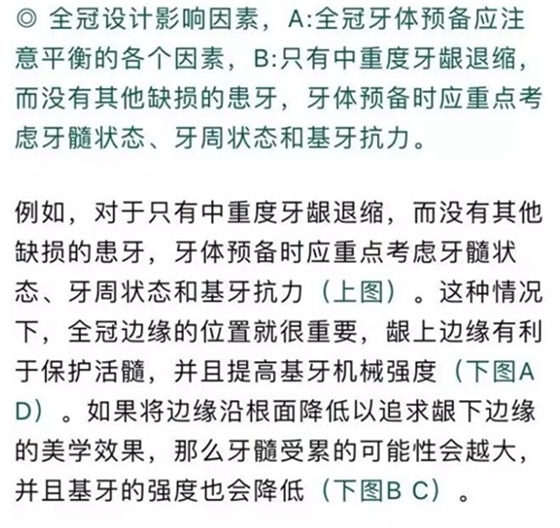 做全冠修復時基牙根面暴露，如何備牙？