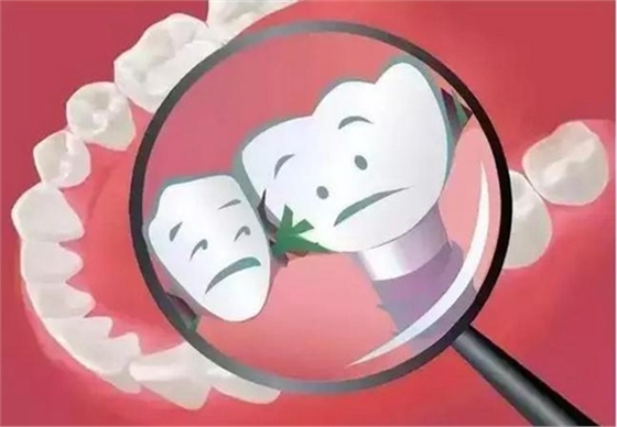 為什么吃東西老塞牙？小心這些??！  