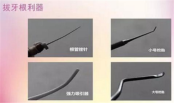 拔牙斷根的去與留？