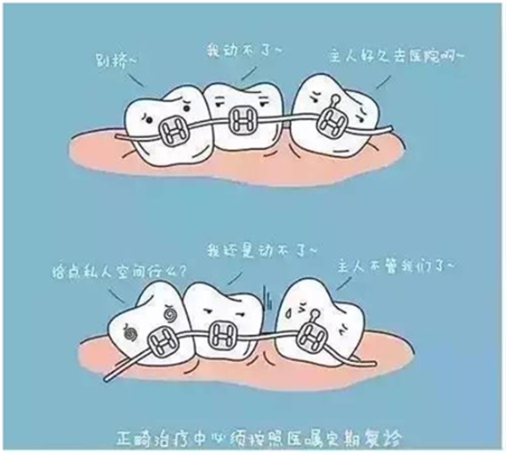 關(guān)于牙齒矯正，你想知道的都在這！