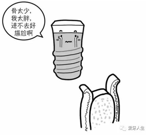 如何選擇種植牙，給《患者》推薦這篇文章就足矣
