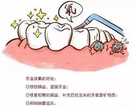 涂氟還是窩溝封閉？到底該給孩子做哪個？