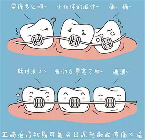 牙齒正畸過(guò)程中需注意哪些事項(xiàng)？