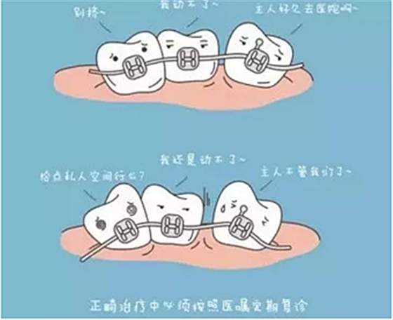 正畸需要注意些什么？