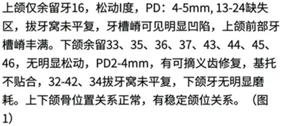 病例報(bào)道│全程數(shù)字化輔助無牙頜種植即刻負(fù)重