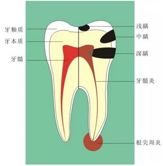 牙齦萎縮怎么辦？