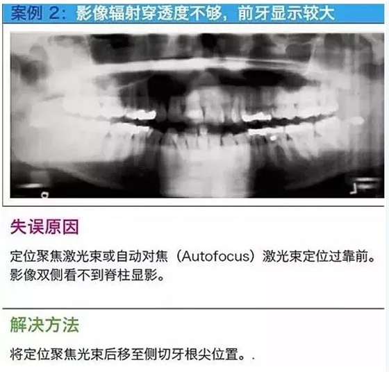 曲斷的10大經(jīng)典失誤案例及原因分析！