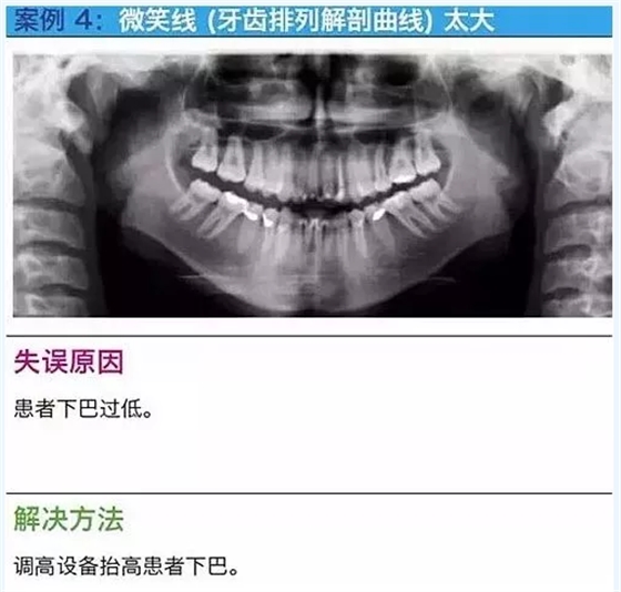 曲斷的10大經(jīng)典失誤案例及原因分析！
