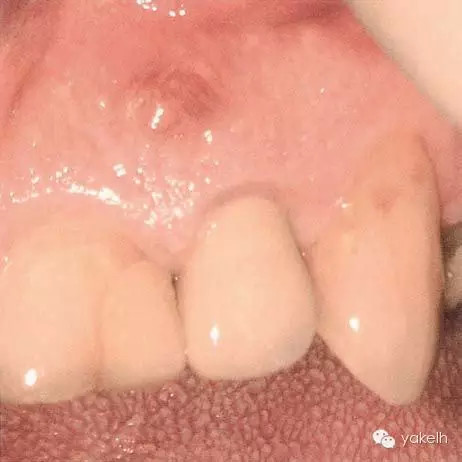 QQ圖片20150711143954.png QQ圖片20150711143954.png