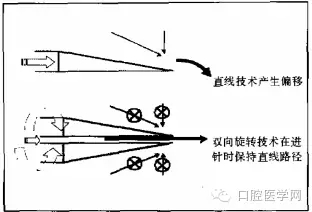 即使是老手也會失手的麻醉----下牙槽、舌、頰一次阻滯麻醉