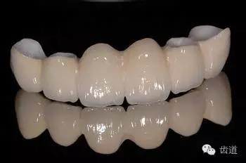 為何烤瓷牙的價(jià)格從幾百元至數(shù)千元不等？告訴您11種烤瓷牙的特點(diǎn)、價(jià)格及優(yōu)缺點(diǎn)