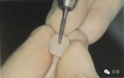 瓷貼面的粘接步驟及技術(shù)要點