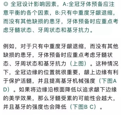 做全冠修復(fù)時基牙根面暴露，如何備牙？