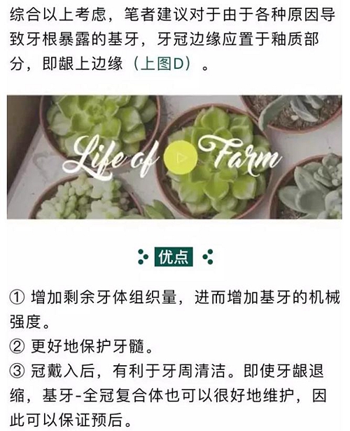 做全冠修復(fù)時基牙根面暴露，如何備牙？