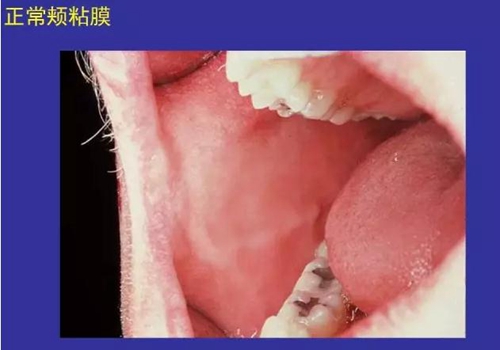 正?？谇火つぜ俺Ｒ姴p圖
