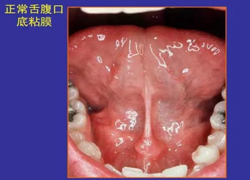 正?？谇火つぜ俺Ｒ姴p圖