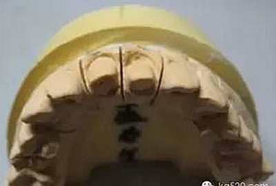 義齒加工技師想對(duì)醫(yī)生說(shuō)的話