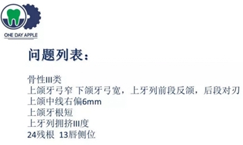 多學(xué)科病例分析---正畸、種植、微創(chuàng)拔牙多學(xué)科交叉病例