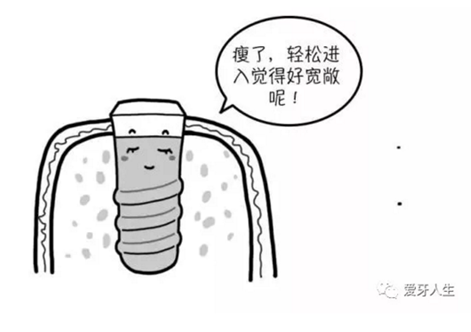 如何選擇種植牙，給《患者》推薦這篇文章就足矣