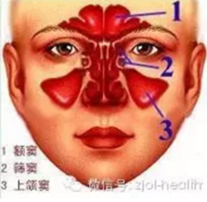 拔牙后引出“偏頭痛”！這種情況絕不能置之不理！