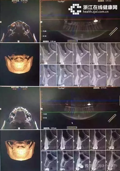 杭州口腔醫(yī)院城西分院