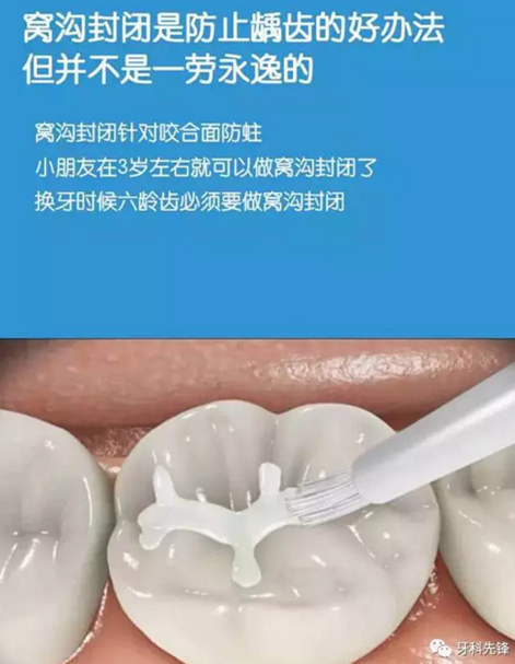 0~6歲寶寶口腔知識(shí)干貨集錦