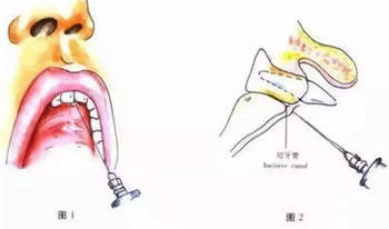 口腔醫(yī)生的十大危險操作，你可能也中過標！