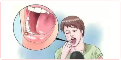 特殊時(shí)期為什么常規(guī)的口腔治療都不能做了？