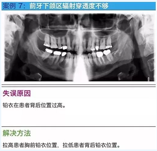 曲斷的10大經(jīng)典失誤案例及原因分析！