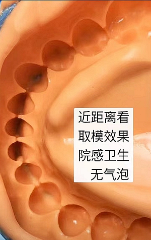 ?？抵Z德藻酸鹽印模材料